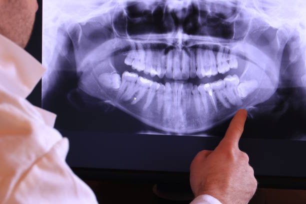 Dentist for Dental Trauma in AZ