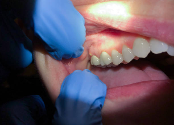 Best Dentist for Dental Trauma  in San Carlos, AZ